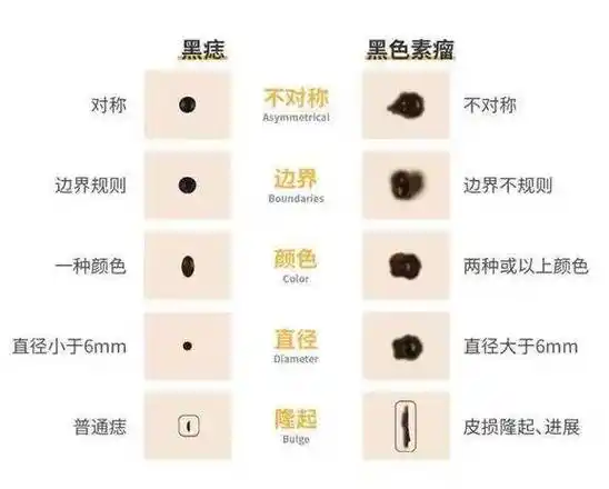 小心长在这几个地方的痣!
