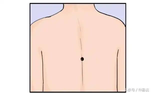 膝盖有痣的人财运好,发际有痣的人最智慧.