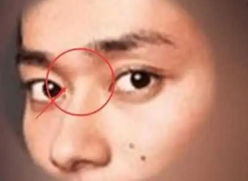 邓丽君属于短命面相吗