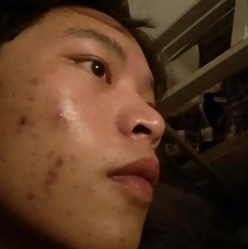 男士护肤推荐丨懒人护肤一个洗面奶与水乳彻底解决出油多痘痘肌土直男