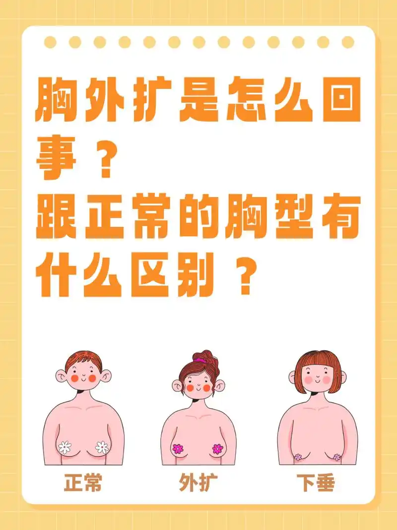 胸外扩是怎么回事?跟正常的胸型到底有什么区别?  🌿实际上,这是乳
