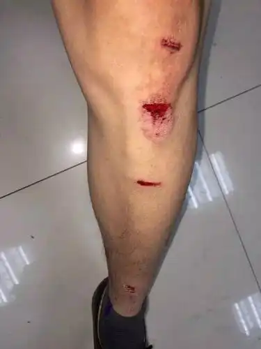 雷锋式警队丨疯牛连伤数人巡警三枪击毙