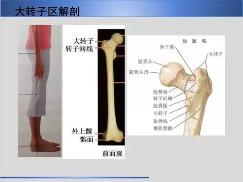 股骨大转子疼痛综合征mr特征