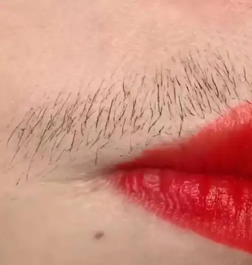 女性长胡须是什么体验提醒这3种情况或会导致女人长出胡子