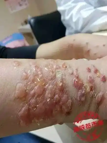 不是所有蚂蚁都可以捏如果看到通体呈铁锈色体长约3～6毫米脑袋特别大