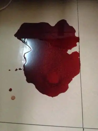 生菌又断食了几个小时,昨天它也没食欲,今天早上就发现地上好大一滩血