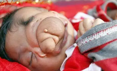 印度女人生下一个畸形孩子,因为一个特征,而被供为神灵!