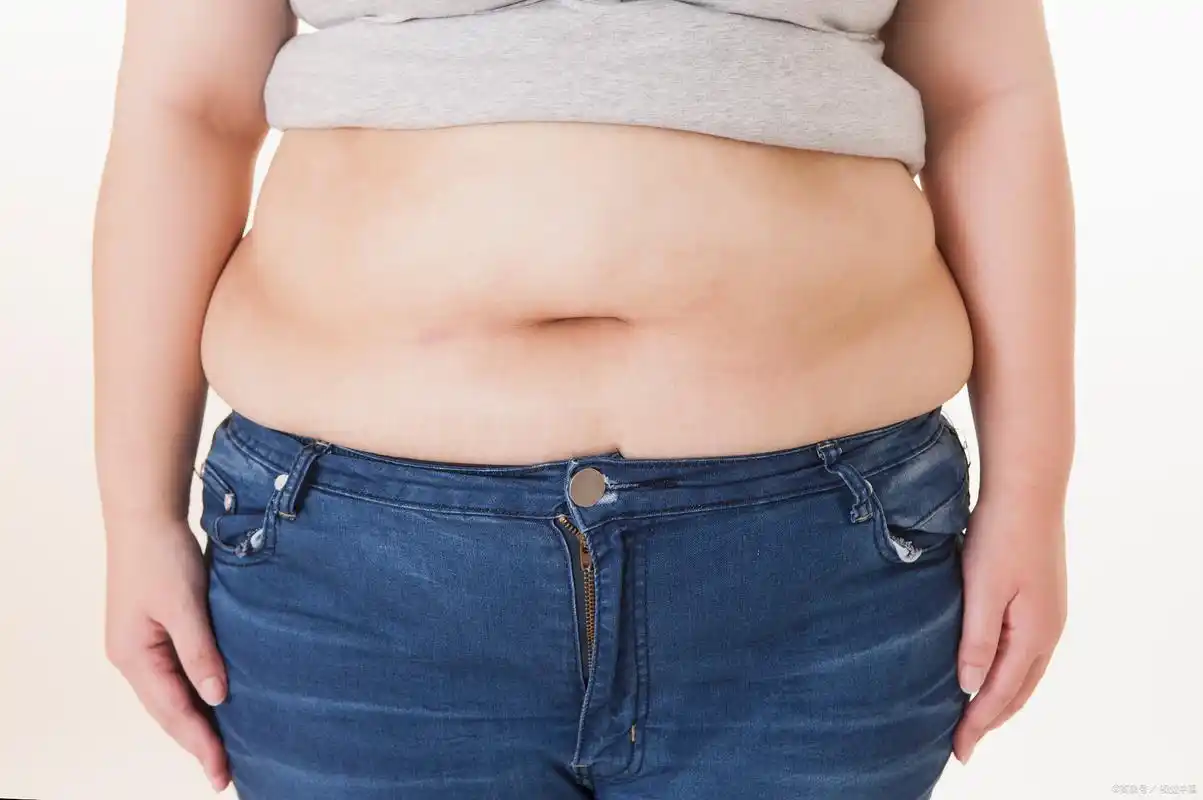 肚子肥胖可以做抽脂手术吗 #医美科普挑战赛#   对