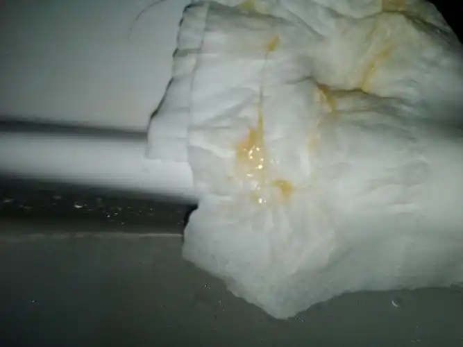 孕晚期38周 6分泌出这么黏液,无气味是什么情况.