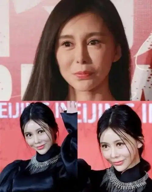 本来就很美的明星过度整容老了会变成什么样网友直呼没眼看