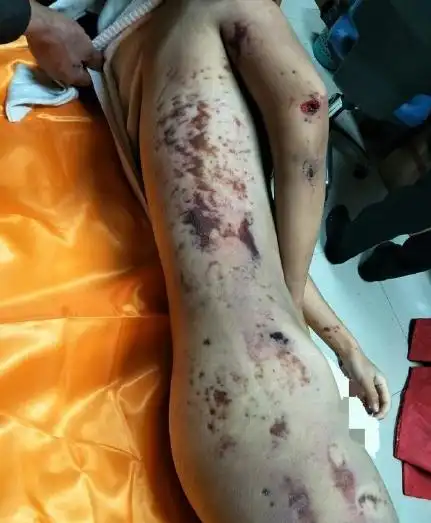 济南女学生裸体坠楼事件 警方通报:系跳楼自杀