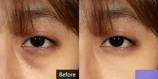 官方宣称"使用4周眼下细纹就能有效减淡近15%,8周可以淡化27%".