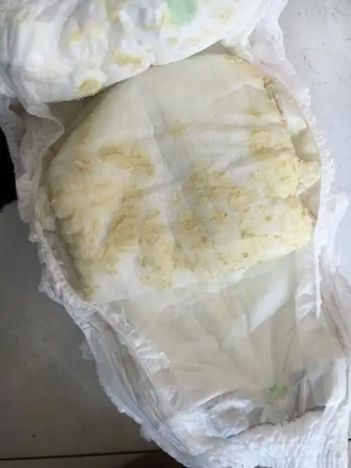 宝宝拉水一样的白色便便