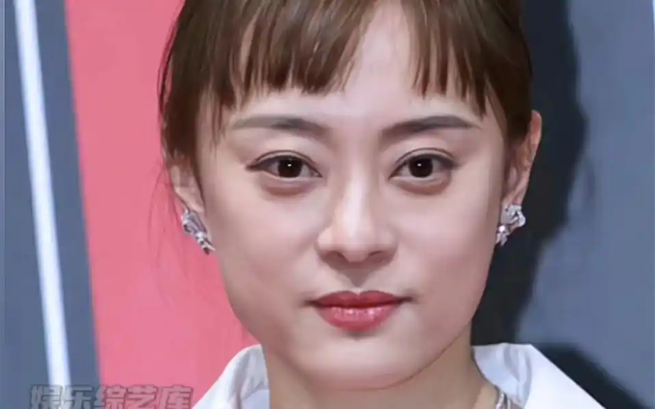 孙俪脸部状态引热议 #孙俪