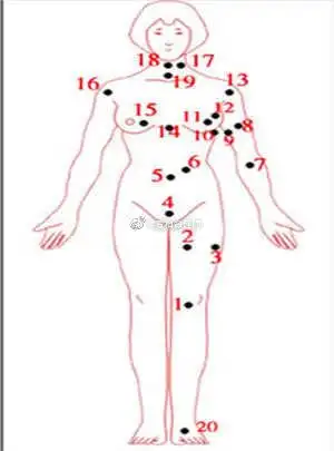 女人全身长痣图解析(上)长痣处(1):在膝盖上长痣的女人:天性很慈悲很