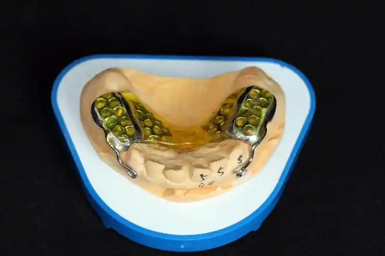 上领口内粘接式前方牵引器