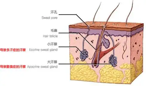 三个原因告诉你狐臭是怎么来的