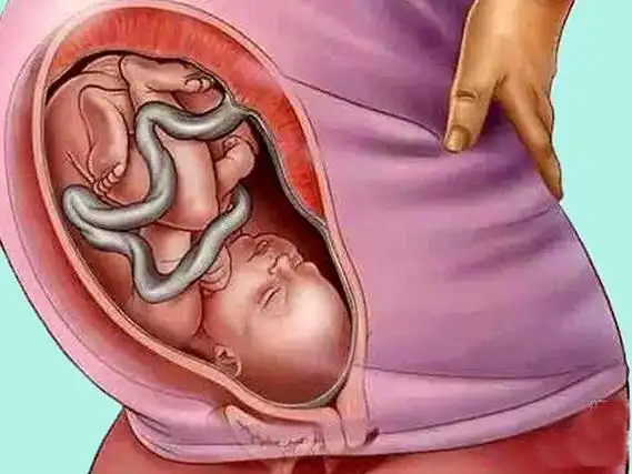 胎盘的位置附着于子宫下段,下缘位置接近或者已经达到宫颈口但是未