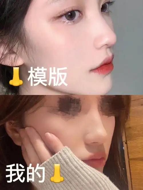 但也算各有各的美吧贾德渊这种微驼峰,鼻子高度弧度拿捏的太细节啦