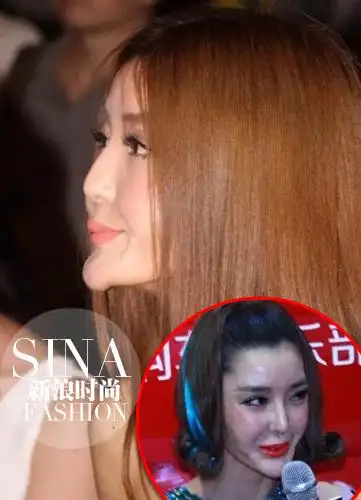 去整容先搞清这些 看看那些年整容失败的女星
