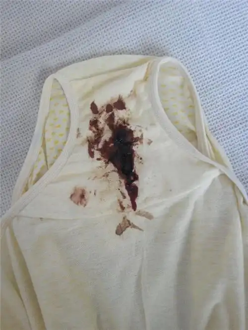 月经后的白带图片搜索