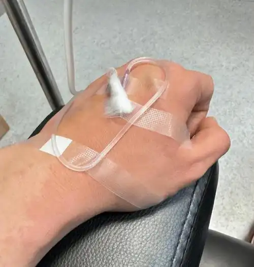 到达医院后,医生简单询问了病情后,马上给黄晓明打点滴,但晒黑的场景