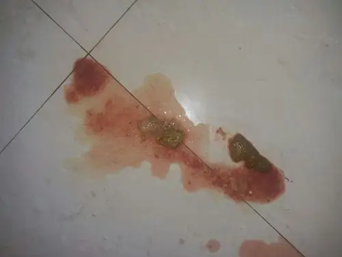 我家金毛四个月托牙期间 突然连拉带吐的 拉血是怎么回事 各位帮帮忙