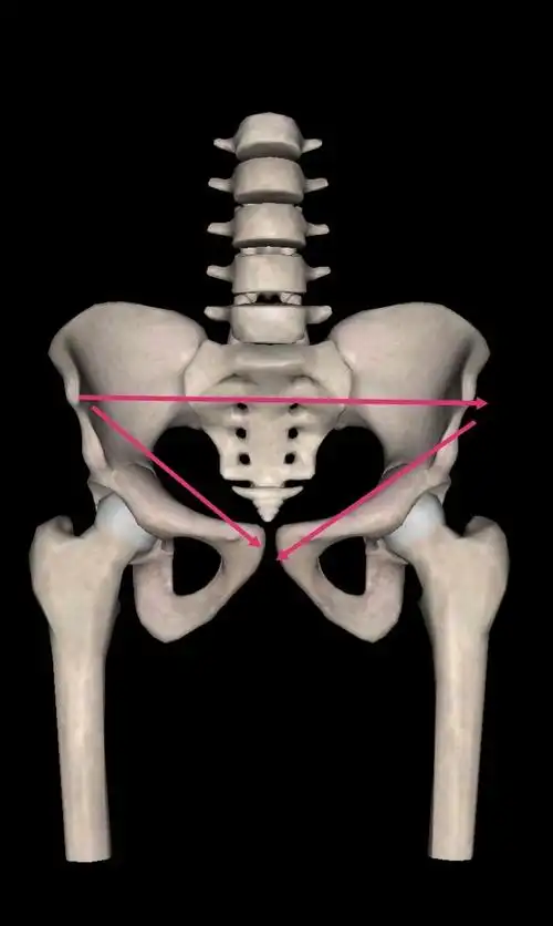 骨盆前倾如何自我判断?