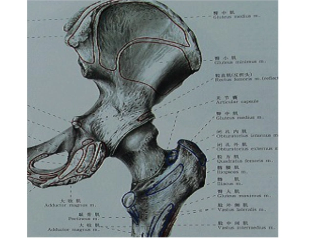 骨质疏松性股骨粗隆间骨折课件.ppt