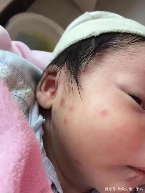 蚊子"最大的天敌"并不是蚊香?教你1个笨方法,彻夜开窗都不怕