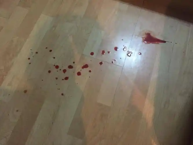 我家一岁的阿拉来月经,量越来越多,好吓人,地板上都是,这正常么?