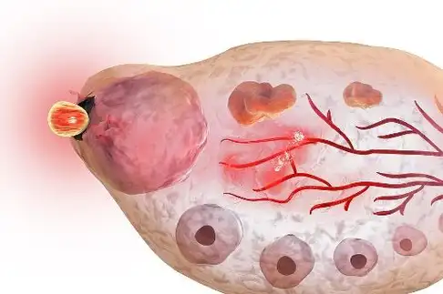 所以女人不排卵时应该多吃这些食物,有效补充体内的雌激素,就能有效促