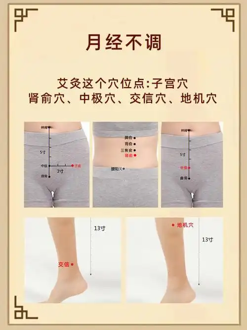 艾灸女性专属穴位对于女性常见的妇科问题