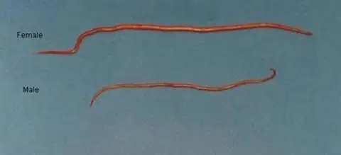 262,216,302 问题已被解决相关生物 人蛔虫 属大型的人体寄生线虫