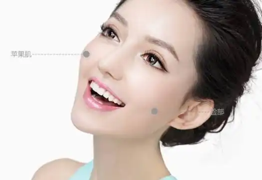 如何让苹果肌"嘭"起来?自体脂肪填充了解一下!