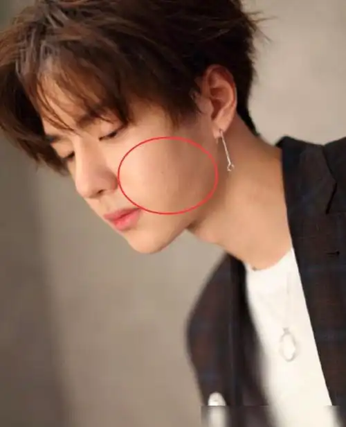 王一博生图吓退粉丝颜值翻车皮肤暗黑痘痘肌明显与精修差距大