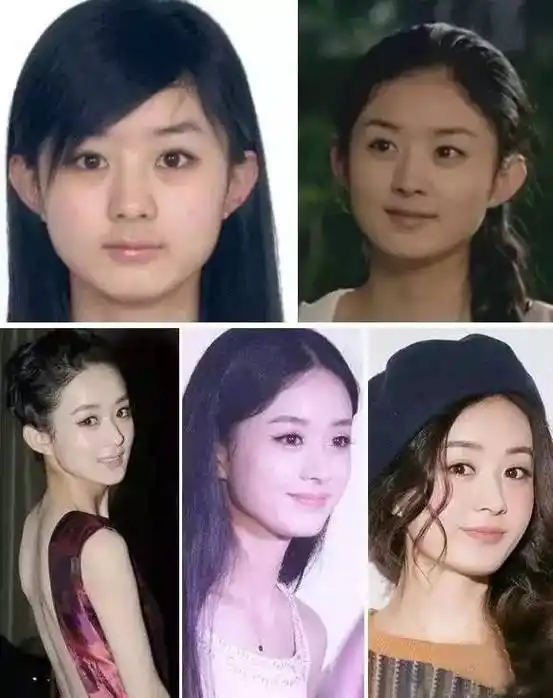 曝10位女星令人惊愕的整容前后对比照图