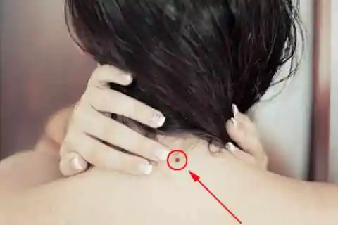 脖子后面有痣的人运势怎么样