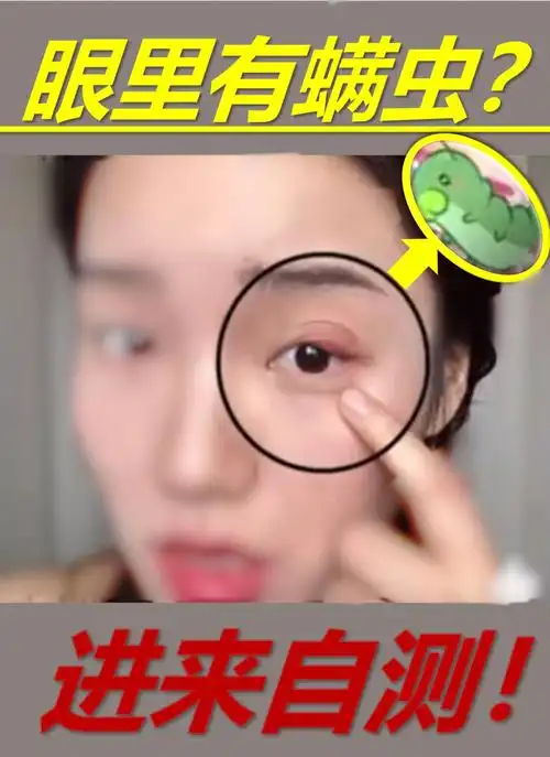 你的眼睛还健康吗