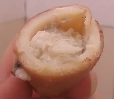 这次是一条一条的像虫子一样的东西 不会是寄生虫吧0