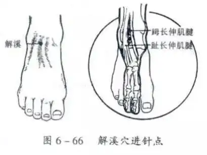 其它 髋膝踝关节穿刺技术 写美篇踝关节腔前侧进针法 解溪穴进针点