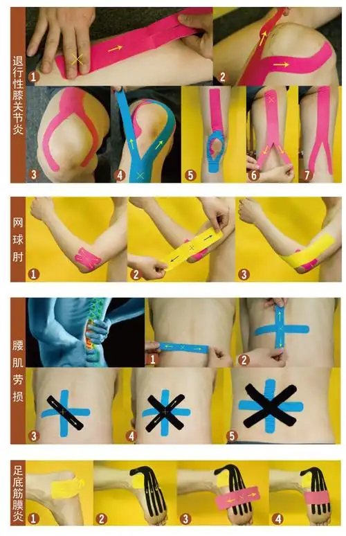 肌内效贴布胶布运动胶带自粘绷带理疗肌肉贴滑雪冻脸贴跟腱后跟贴