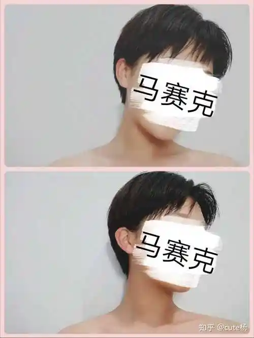 有什么高中生女生从超短发到长发的过渡发型推荐?