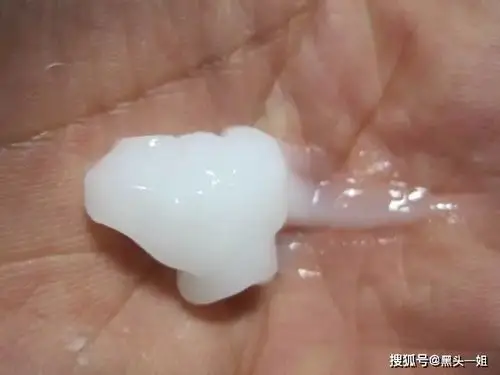 洗澡后鼻子上冒出来的白芯芯白点点是什么呀