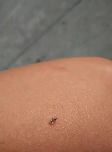 这特么什么虫子,被咬过,好疼.