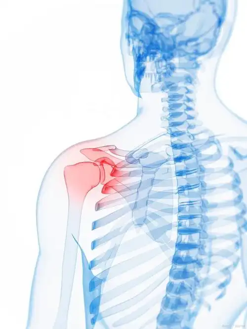 本文将从这些原因出发,分析右肩胛骨疼痛的病因和治疗方法.