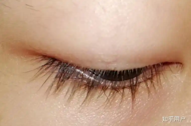 有一单一双的眼睛是啥样