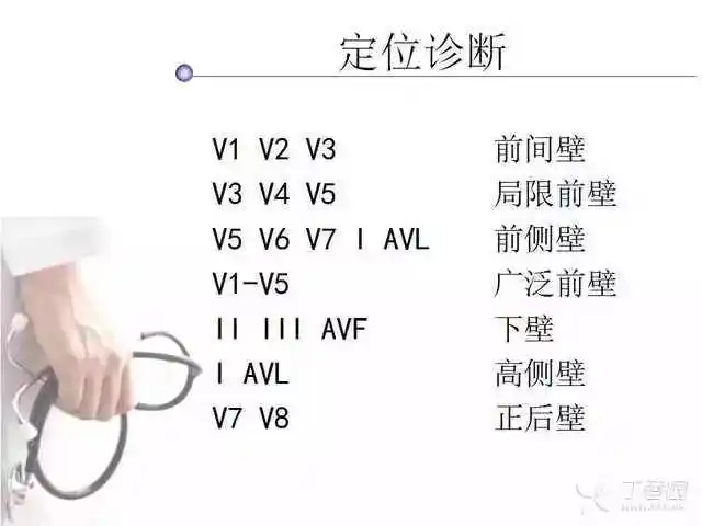 心电图诊断笔记:心肌缺血与心肌梗死