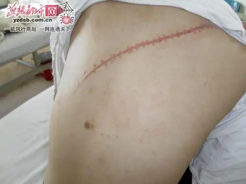 感情不和提出分手 女大学生遭男友刀割喉