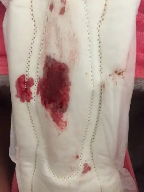 月经流下来这种东西血色这样正常吗?